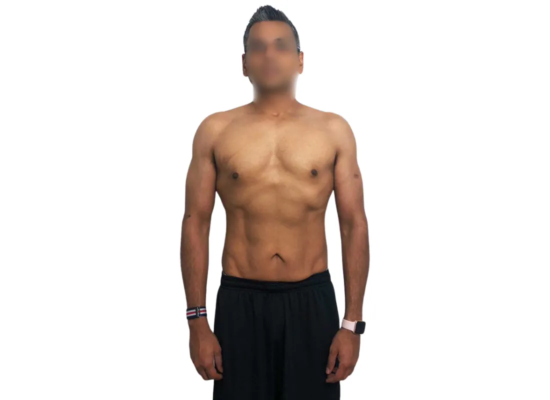 Rahul After