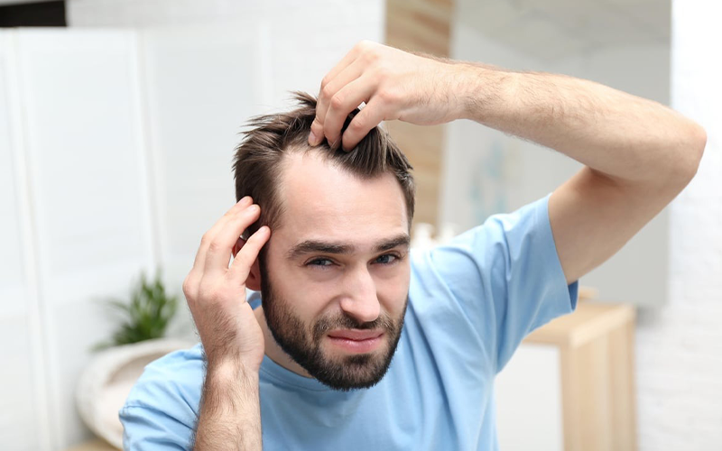Hair Loss